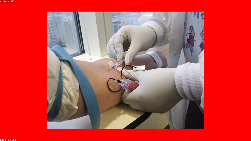 Ảnh hưởng của Ivermectin đối với hệ thần kinh của động vật và người