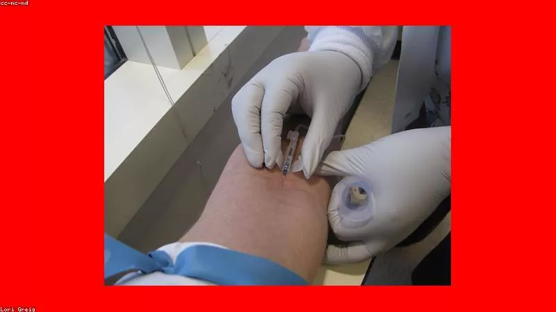Cách tính liều Ivermectin chính xác dựa trên trọng lượng cơ thể người bệnh
